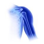 Shoulder orthopedic implants