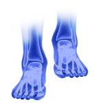 Foot and ankle orthopedic implants