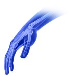 Hand and wrist orthopedic implants