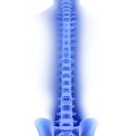 Spine pedicle screw system